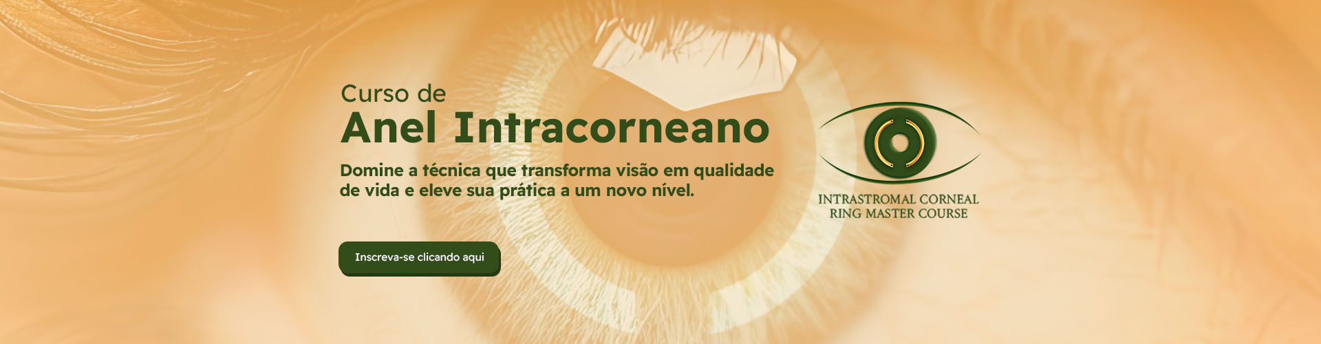 Banner - Curso Anel Intracorneano